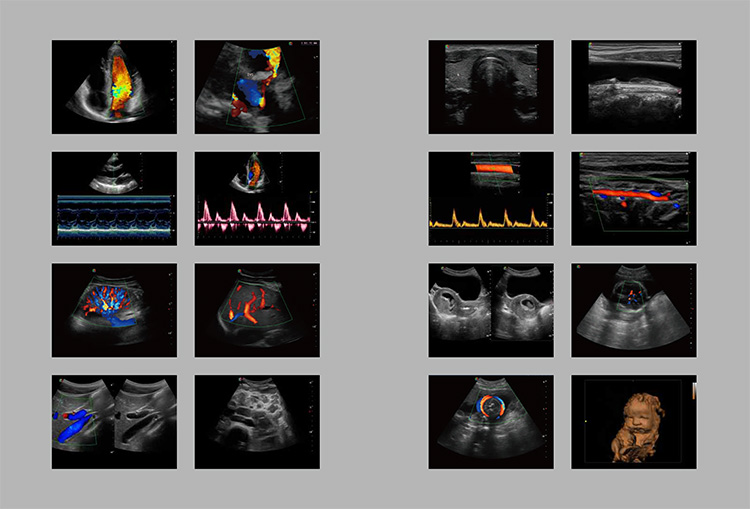 Sonoscape S9 Pregnant Baby Medical Diagnosis 4D Color Doppler Sonography Machine Portable Ultrasound