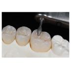 DC Coating Milling Burs Emax Milling Tools For Amman Girrbach Dental