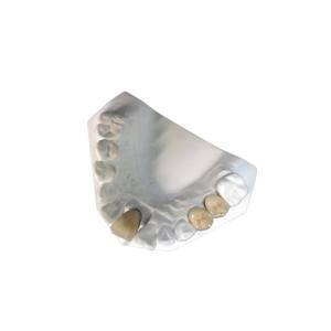 Quality High Stability Ceramic Dental PFM Crown Natural Tooth Stain Resistant wholesale