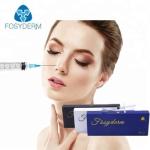Hyaluronic Acid Injectable Dermal Filler For Nose Enhancement Natural Looking