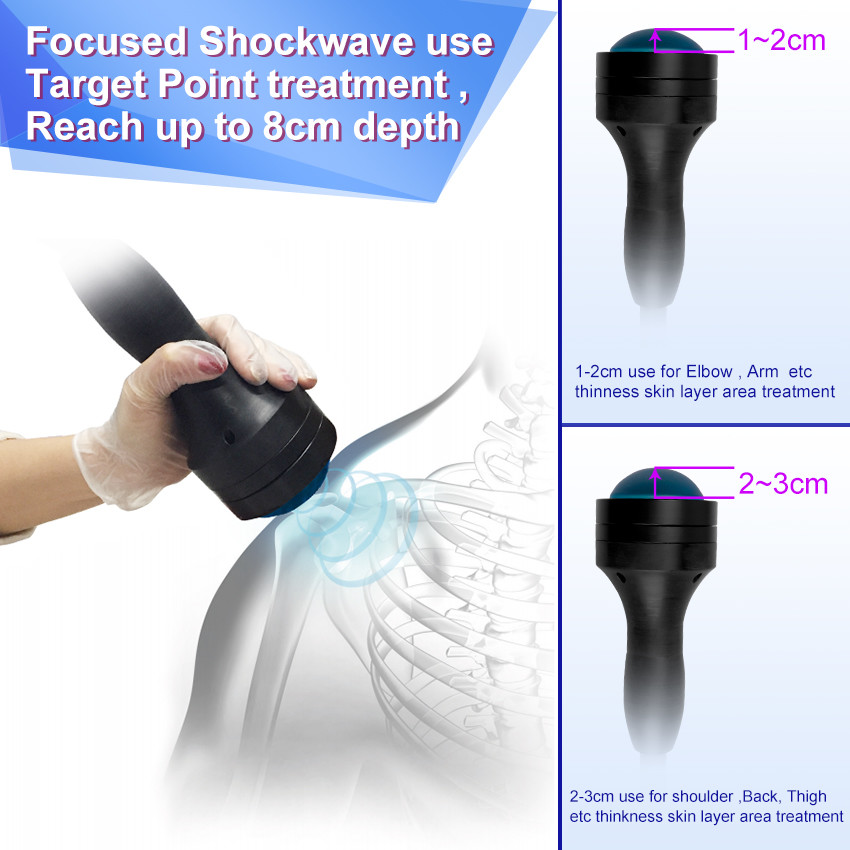 Professional Eswt Shock Wave Machine Eswt Shockwave Therapy Machine Erectile Dysfunction Treatment