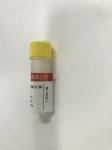 KISSH Primary Antibody Products Ki-67 Immunoassay Antibody Test IHC 1.5mL 3.0mL