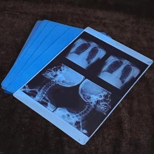 Quality 8x10 inch 100 sheets/pack 10 packs/box Thermal Film for Inkjet Printing Size Package wholesale