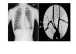 High Sharpness Xray Paper Films , Agfa Dt2b Fuji Medical Thermal Films