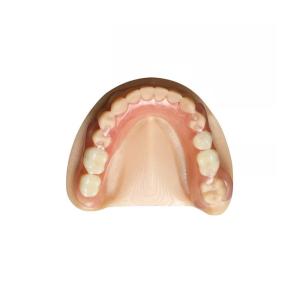 Quality OEM Zirconia Dental Crown Removable Denture Professional Dental Laboratory wholesale