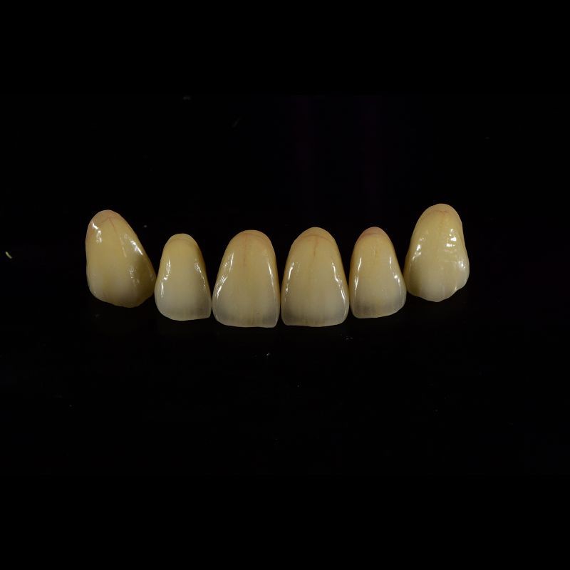 Tooth Multi Layered Zirconia Crown for Restorative Dentistry