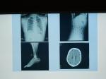 Konida X Ray Medical Imaging Film Waterproof For Agfa Printer