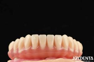 Quality 1 Piece Ti-Base Acrylic Teeth Finish Translucent Color Dental Acrylic Resins wholesale