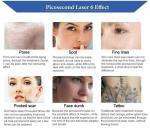 4 Wavelengths Honeycomb Nd Yag Laser Picosecond Laser 1064nm Tattoo Delete