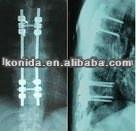 High Density Medical X Ray Film Blue For Konida Laser Printer