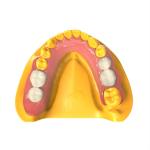 Biocompatible Invisible Denture Base Resin Dental Resin