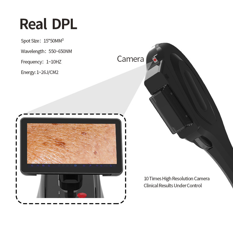 Permanent Opt Shr Ipl Laser Skin Rejuvenation Elight
