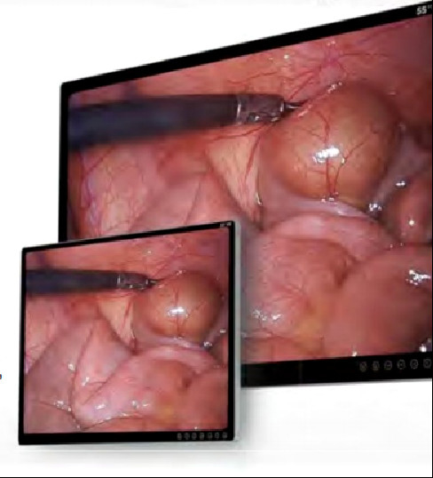 19in FHD Monitor Surgical 4K Endoscope Camera Anti Glare BTH-9100