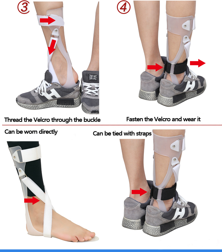 2022 New Design PP splint universal ankle foot support orthosis AFO Leaf Spring