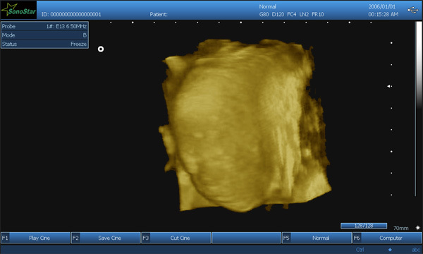 PC based 3D Ultrasound Machine SS-9 Laptop Ultrasound scanner