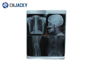 Quality 100 Sheet / Pack X Ray 44m Medical Radiation Printing Film wholesale