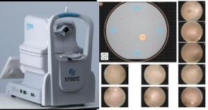 Quality Professional Non Mydriatic Fundus Camera For Accurate Imaging wholesale