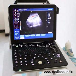 Quality Hospital 4D Fetal doppler Ultrasound Scanner wholesale