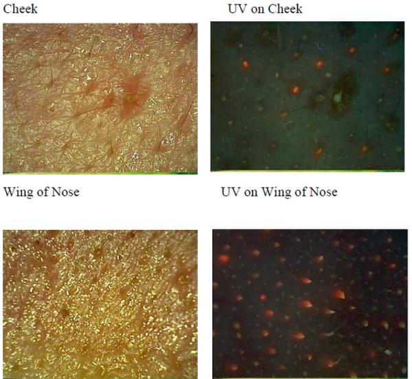 Facial Uv Skin Analyzer Machine For Skin Mositure / Grease / Wrinkle /