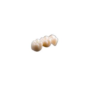 Quality Wear Natural Ceramic Dental Crown Rich Manufacturing Experience Comfortable wholesale