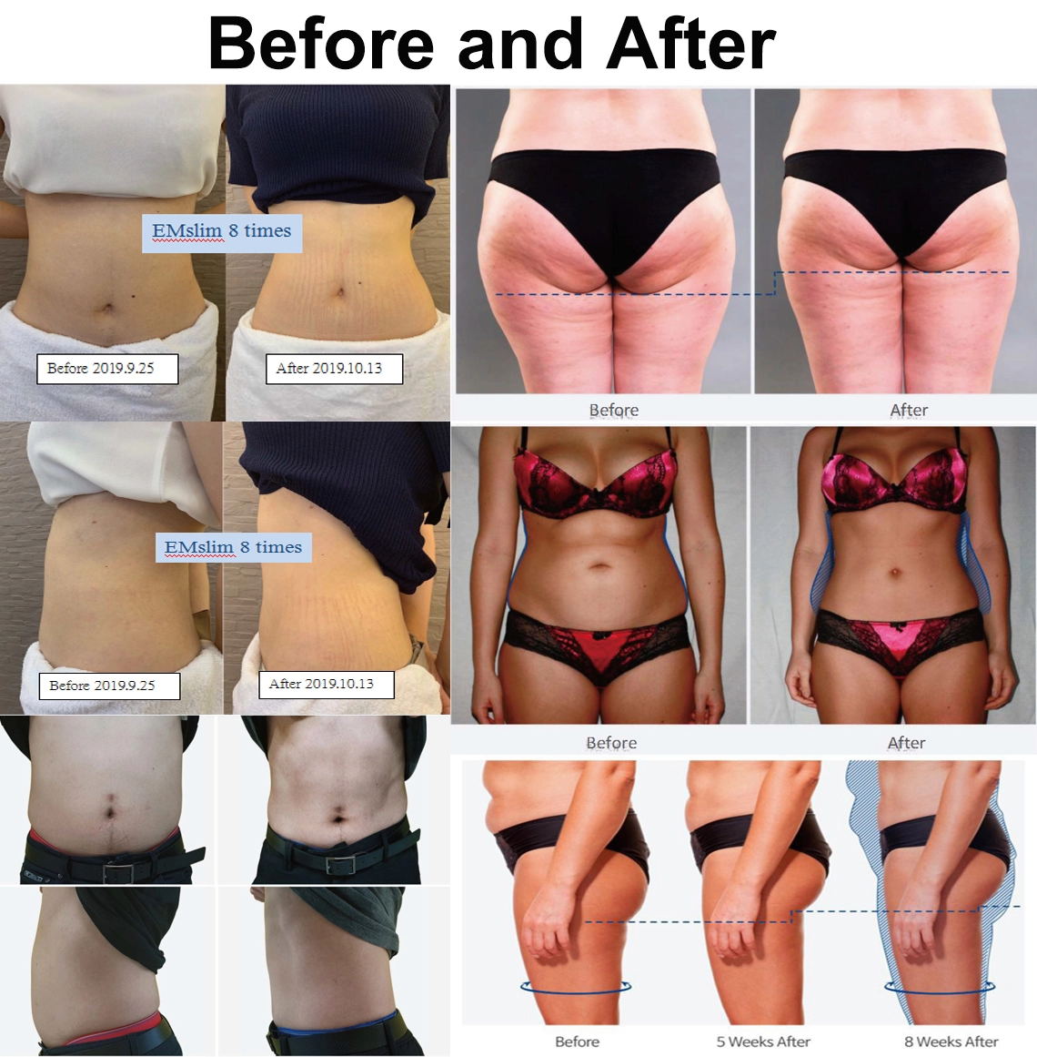 Four handles Commercial EMS Slimming Machine 150HZ For Weight Loss