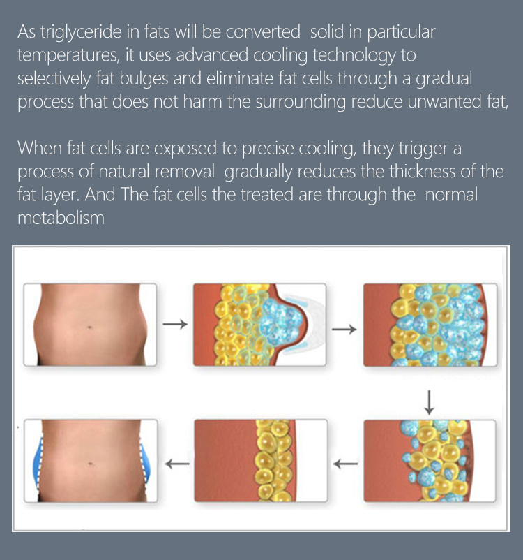 OEM Portable Cryolipolysis Machine , Cryo Weight Loss Machine 200W