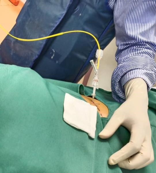 980nm PLDD Minimally Invasive Laser
