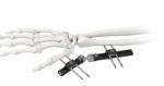Orthopedic Wrist External Fixator Standard Single sided Integrated