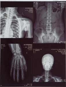 Quality Laser Film for Medical X-ray Image Output Printing wholesale