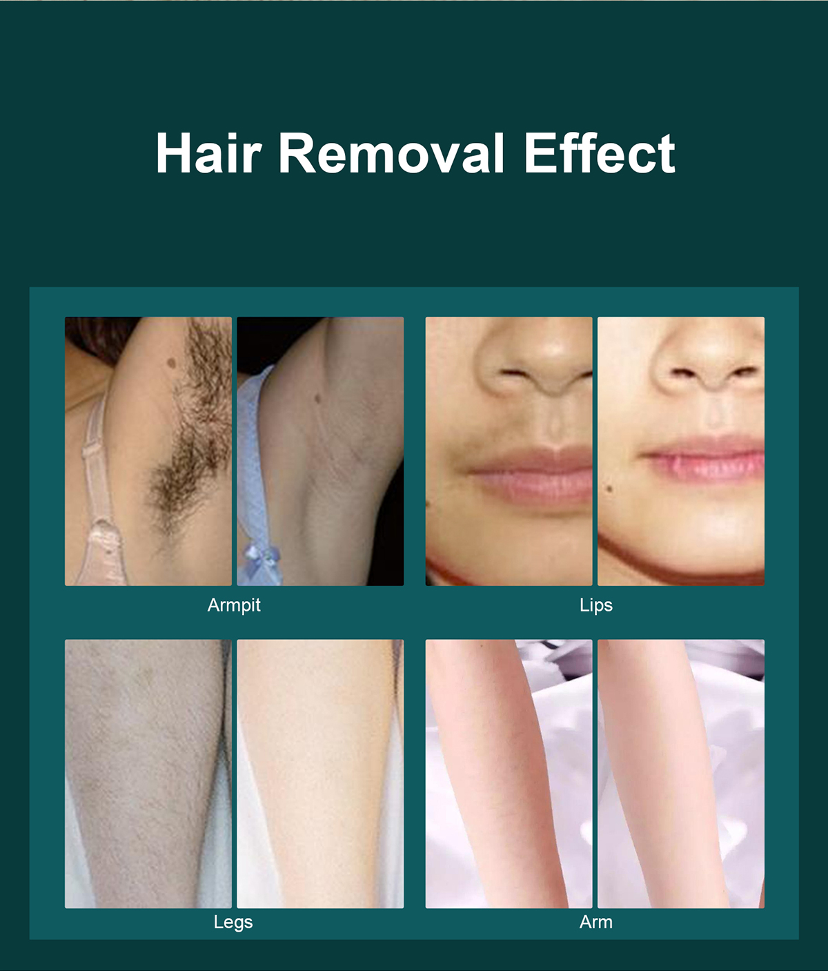Freezing Point Laser IPL Hair Removal Epilator 990000 Flashes Home Use Portable Ice Cool Painless Hair Remove Device Dep