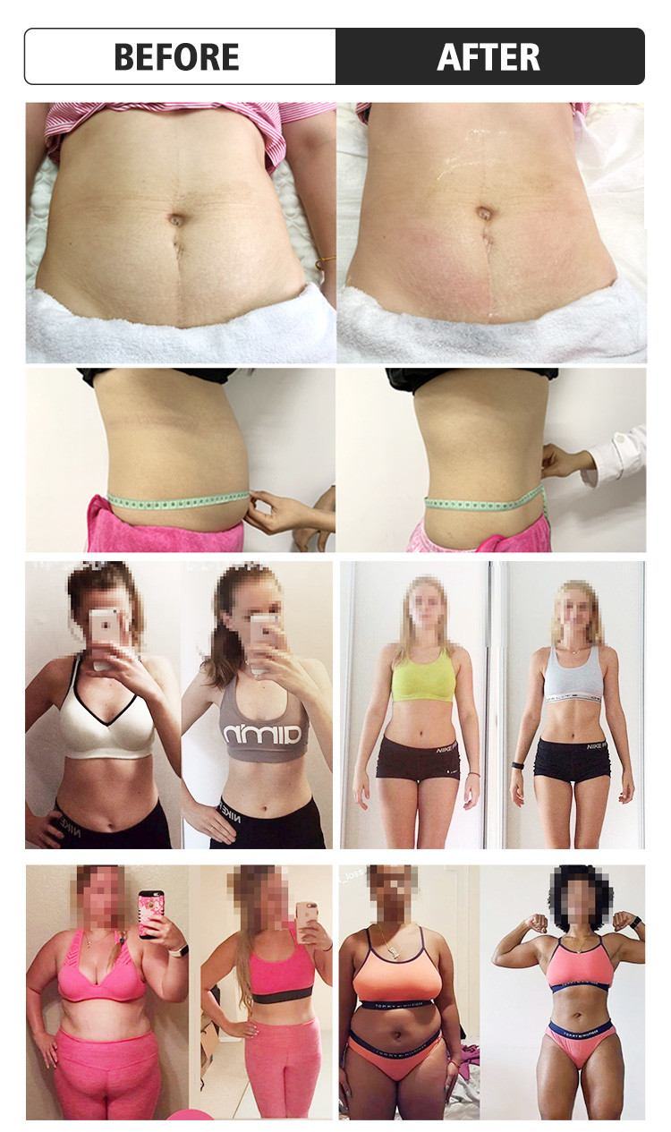 Non Surgical Body Fat Freezing Machine Air Cooling Body Contouring Equipment