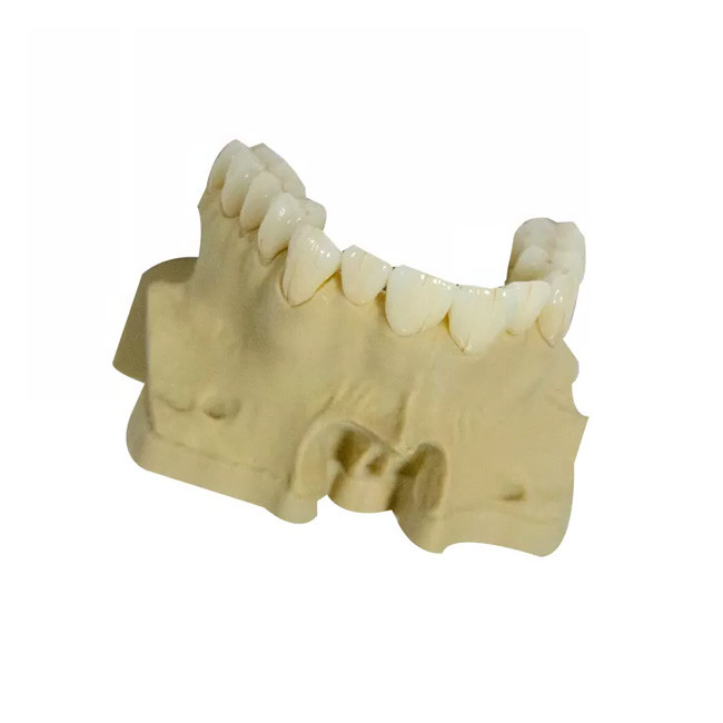 Smooth Surface PFM Dental Crown High Strength Realistic Appearance