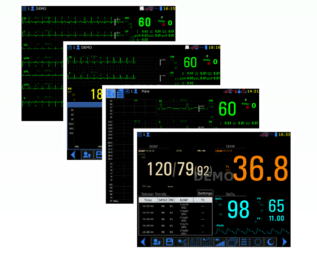 15 inch TFT screen multiparameter medical mobile ambulance patient monitor for hospital
