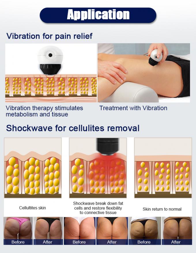 Portable Extracorporeal Shockwave Therapy Machine For ED Treatment And Pain Relief