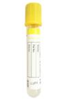 Blood Collection Tube 2ml-8ml Yellow Cap Gel Clot Activator Tube For Blood