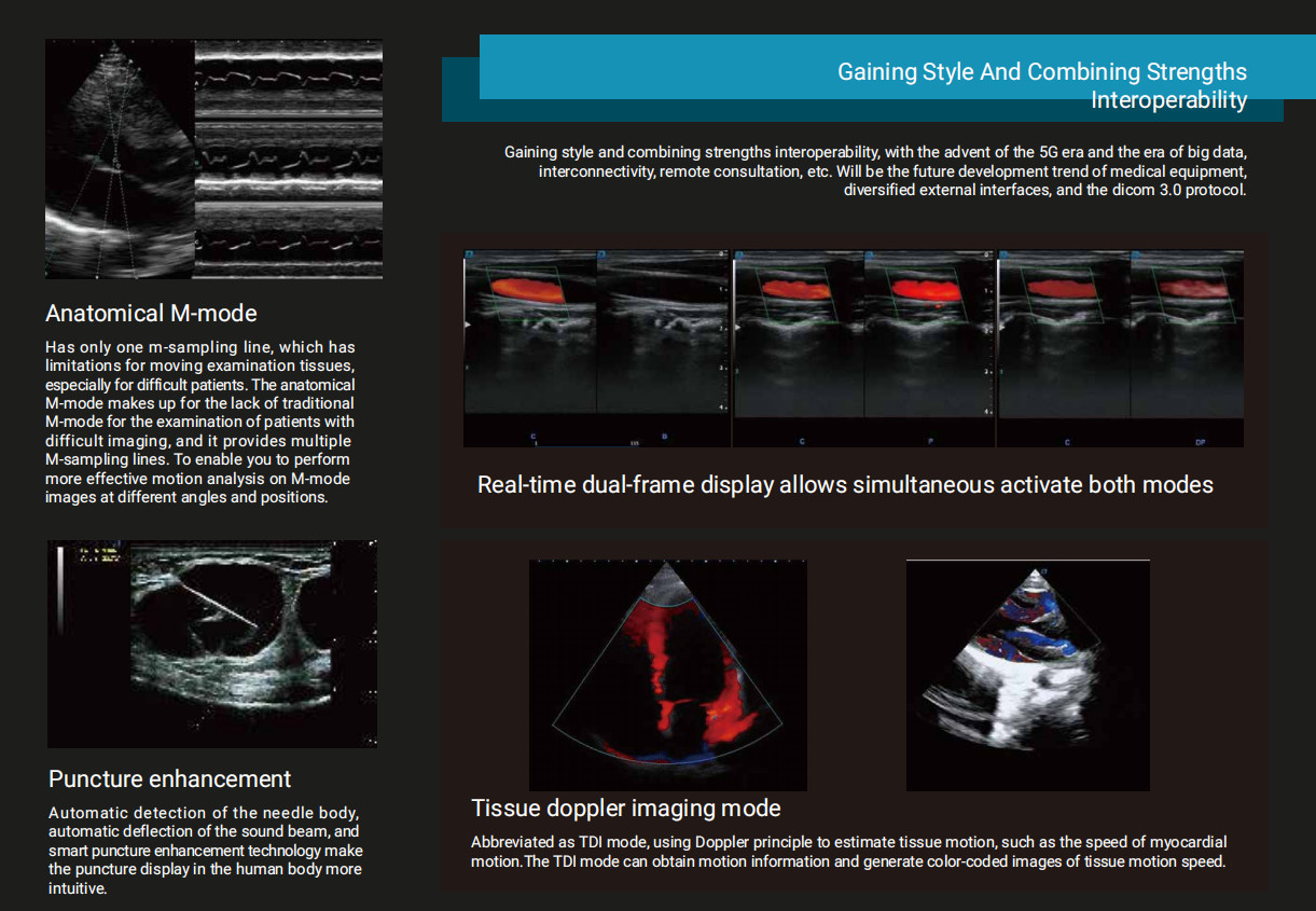 3D 4D 5D Vascular Medical Ultrasound Instruments Portable Color Doppler Ultrasound