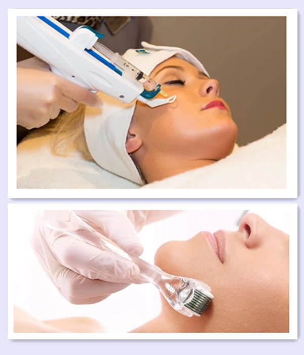 Cross Linked 10ml Injectable Sodium Hyaluronate Gel Pcl Skin Booster Meso Pdrn Solution