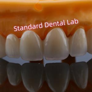 Quality Anterior Restoration Zirconia Bridge Crowns For Missing Teeth wholesale