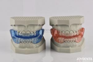 Quality Custom Fitting Sleeping Aid Mouthpieces Dental Appliance To Stop Snoring wholesale
