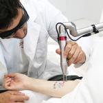Stationary Style Picosecond Laser Machine 2000W Q Switched Nd YAG Laser Tattoo