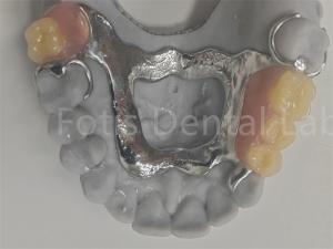 Quality FDA Easy To Clean Removable Partial Denture Compatible With Natural Teeth wholesale