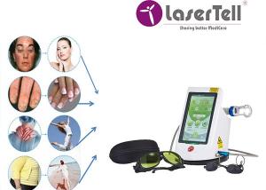 Quality 980 Nm Diode Laser Spider Vein Machine For Vascular Removal wholesale