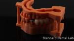 Post Core Dental Lab from China / Metal Post Core with PFM Crown
