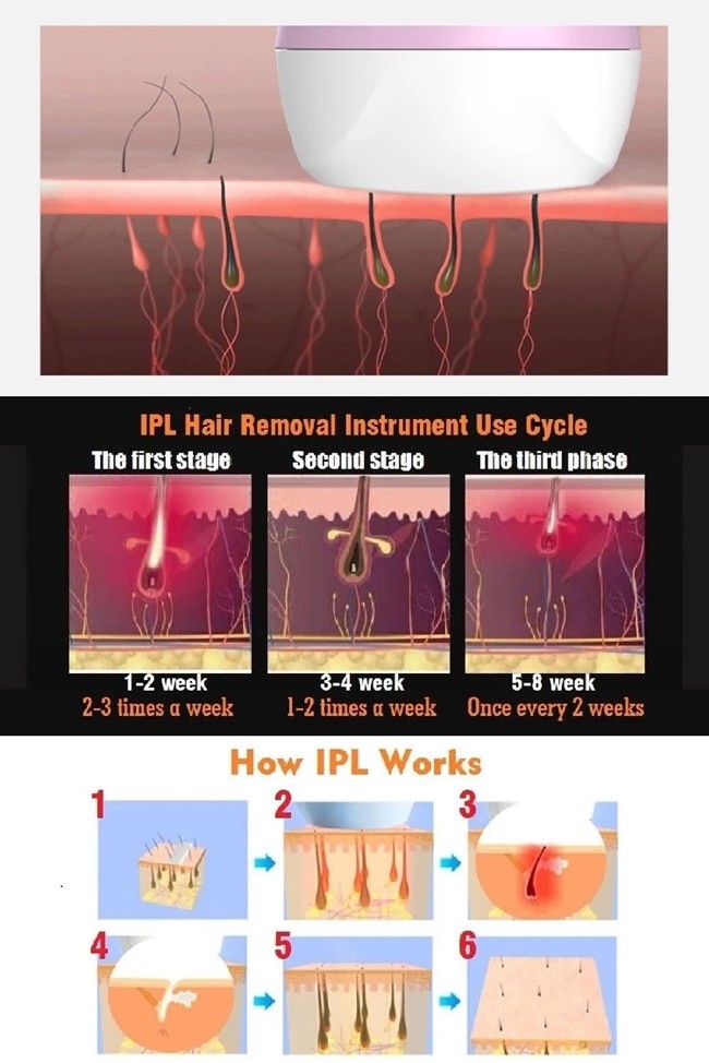 Permanent 500000 Shots 3.3 cm2 Light Area IPL Laser Handset