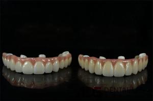 Quality OEM White Tooth Implant And Bridge Dentistry Natural looking wholesale
