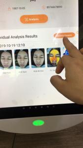 Quality Cosmetics Skin Analyzer Product Suggestion Database 2 Years Warranty wholesale