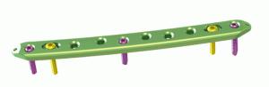 Quality CE Lateral Hook Proximal Femoral Locking Plate wholesale
