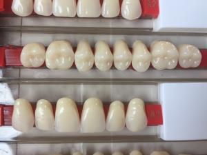 Quality High Strength Artificial Dental Acrylic Resin Teeth With High Biocompatibility wholesale