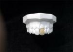 Good Biocompatibility Porcelain Dental Crown High Tech Biological Material