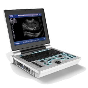 Quality 12 Inch BB USG Laptop Ultrasound Machines Scanner mobile Li Battery wholesale